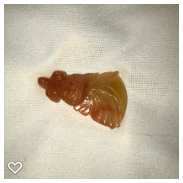 a065-20th Century Coral  Gemstone Button of Carved Realistic Koi Fish